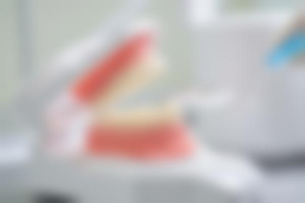 牙齿正畸怎么选医院？正畸科医生团队与技术设备是关键