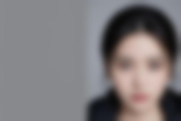 4、邓裴医生还擅长其他面部年轻化项目