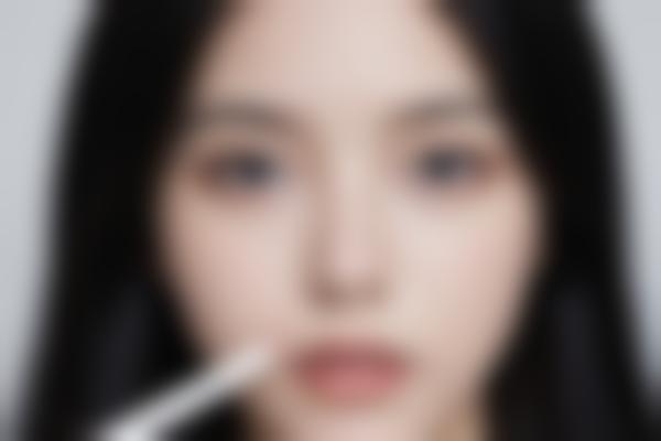 2、付俊俐双眼皮手术自然灵动