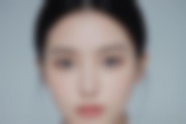 佛山华美整形苏晖展医生：微整形抗衰领域的实力派，自体再生注射让肌肤重返年轻态！