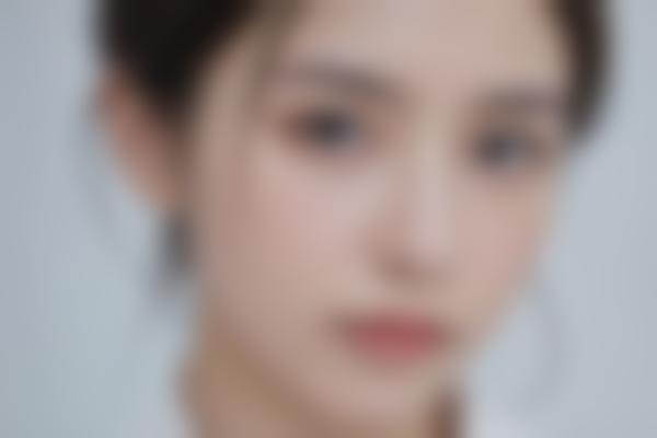 1、刘跃珠假体技术