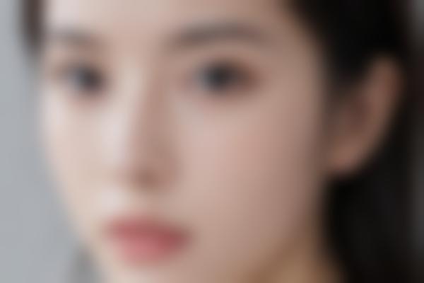 4、何晓娅鼻整形术后护理到位