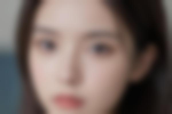 江阴曹志金眼鼻修复超自然！红房子曹志金医生专攻微创整形2万起