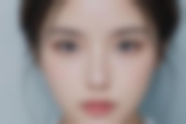 1、静萍胎记修复技术优势