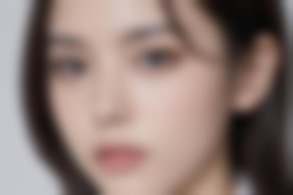 为什么选择廉惜然医生做馒化脸修复？