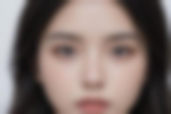 向艺医生鼻整形价格是多少？