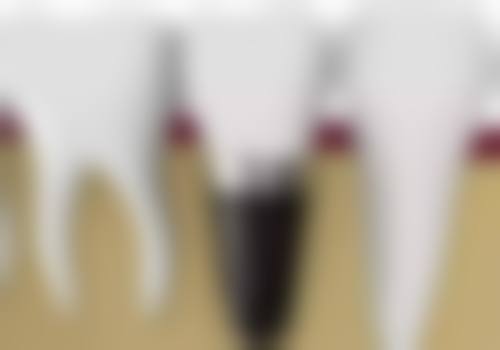 六、湖北潜江众大口腔口碑如何？