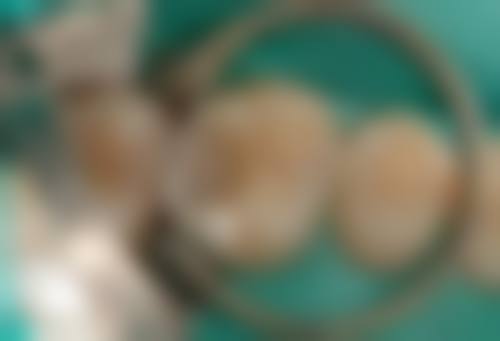 八、浏阳社港牙贝康口腔(熊梅门诊)怎么预约？