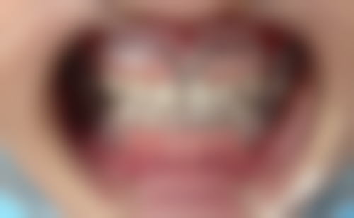 七、广州丽雅口腔何思曼医生怎么预约？