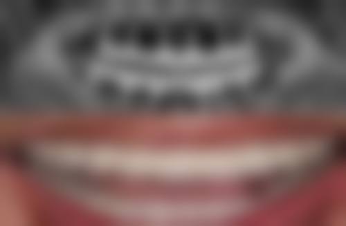 七、洛阳友好口腔段朝阳医生怎么预约？