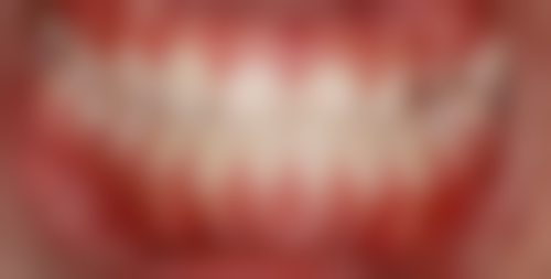 七、深圳汪洋口腔颜彬强医生怎么预约？