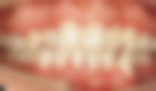 五、徐州宗斌口腔收费价格表