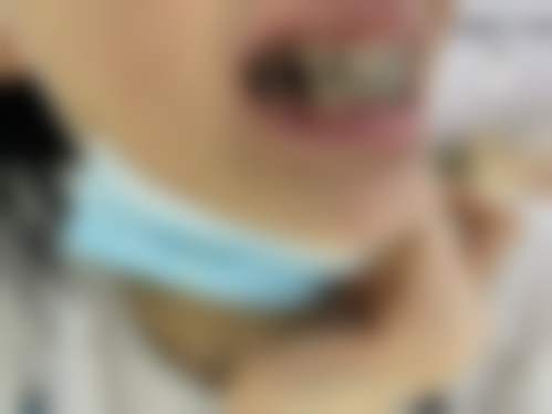 五、上海蓝天万众医院口腔科收费价格表