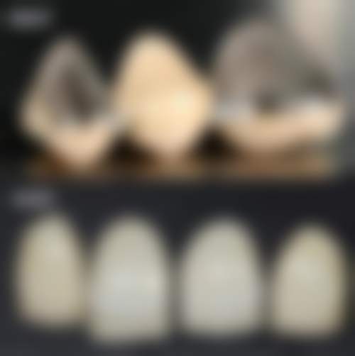 四、金华口腔医院特色项目