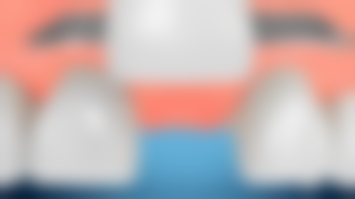 如何选择适合自己的补牙材料