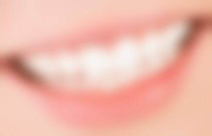 小孩子蛀牙需要做根管治疗吗？这得看龋坏程度，波及牙神经才需做，治疗方案有差别！ 