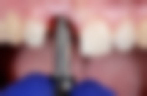 五、连云港梯瓦口腔（灌云店）收费价格表