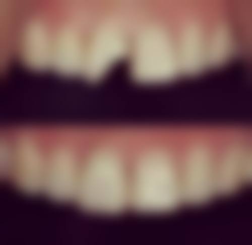 八、威海张鹏口腔怎么预约？