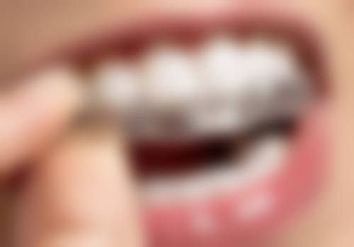 六、广东佛山惠心口腔口碑如何？