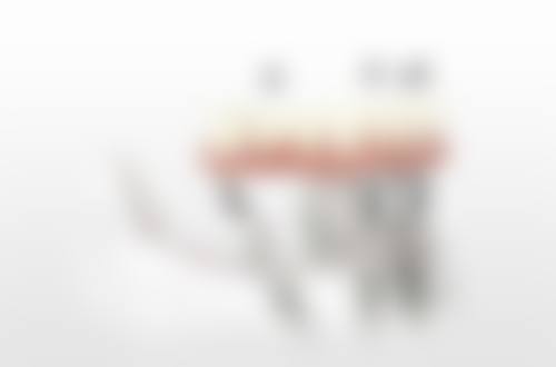 四、上海科瓦口腔特色项目