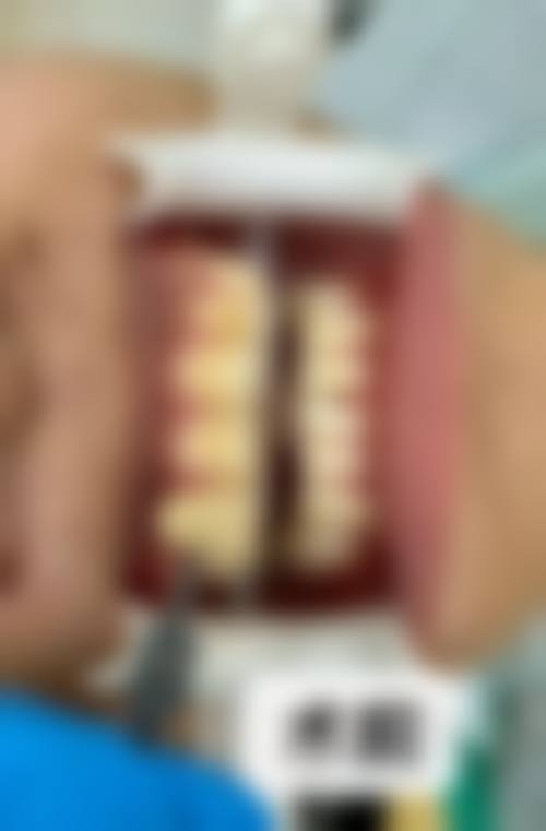 五、陕西咸阳悦康盛口腔收费价格表