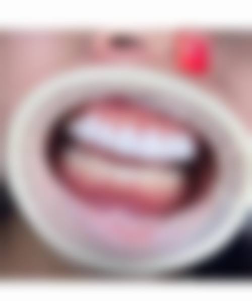 五、桂林周民霞口腔诊所收费价格表