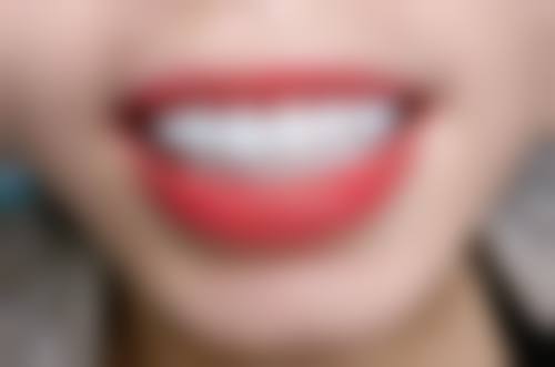 六、江苏常州徐慢莉口腔诊所口碑如何？