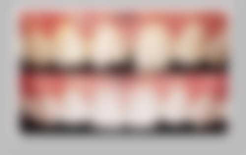 根管治疗1000多贵吗？需结合牙齿位置、根管数量、地区经济及牙齿状况等综合考量！ 