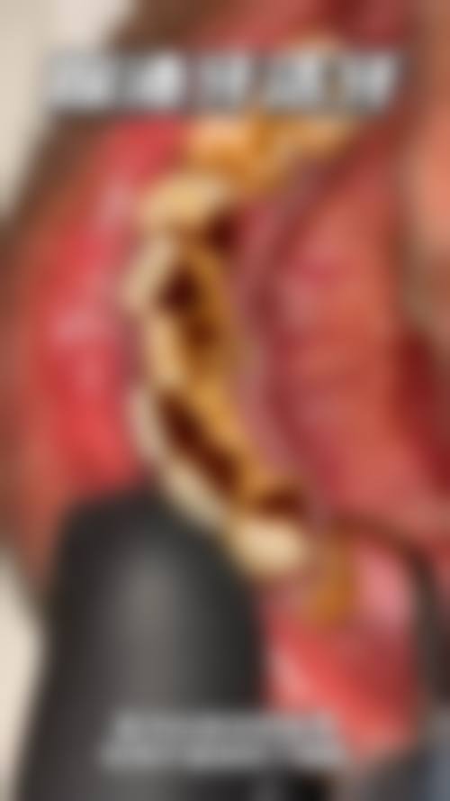 五、重庆南岸区李俊口腔收费价格表