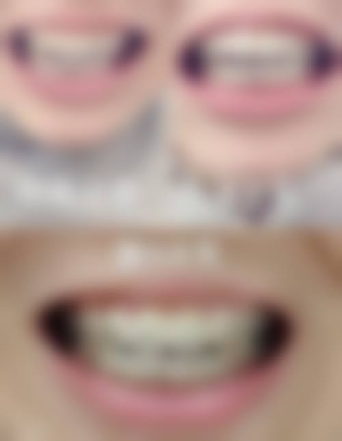 五、济南历下卓誉口腔收费价格表