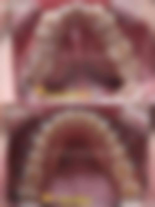 六、平顶山贝斯特口腔医院口碑如何？