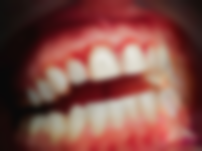 种牙比拔牙还要疼吗？再看看种牙的疼痛状况