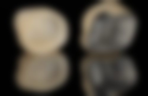 挂号前的准备工作