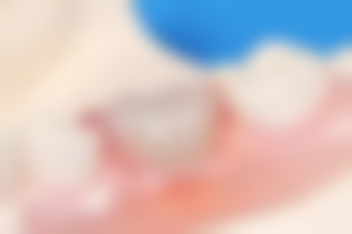 四、喀什海力力口腔门诊部特色项目