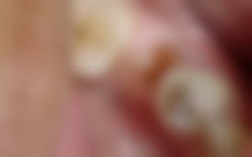 八、深圳武天逾口腔诊所怎么预约？