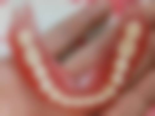 医保卡拔牙怎么报销？需关注范围、比例、流程，异地拔牙也有办法，这些要点别错过！ 