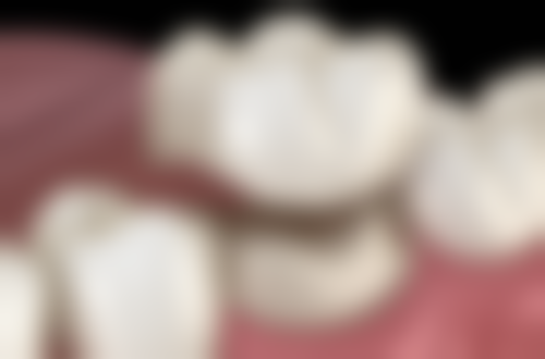 二、沈阳欢乐口腔李春玲医生擅长项目