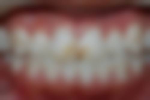 六、沈阳欢乐口腔韩竹医生口碑评价及真人实例反馈