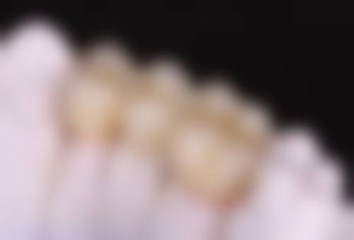 矫正的成效与注意事项