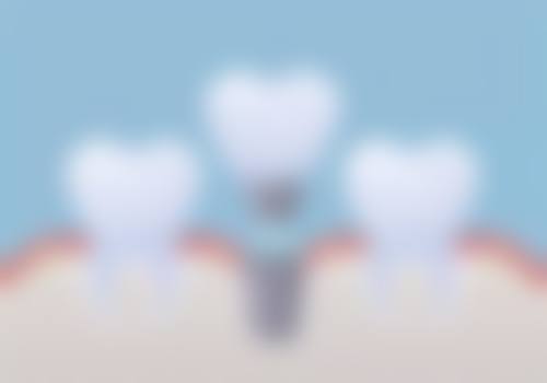 八、张家口嘉信口腔诊所怎么预约？