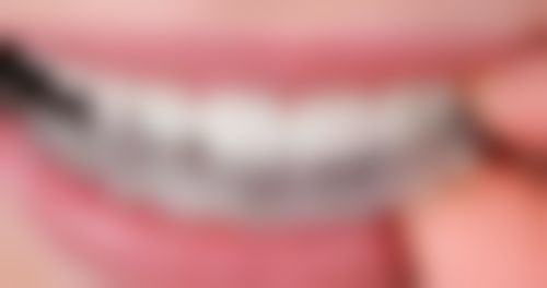 五、沈阳欢乐口腔肖春医生技术怎么样？