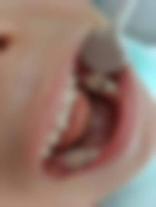 六、无棣华诺口腔诊所口碑如何？