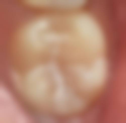 五、西安文信口腔诊所收费价格表