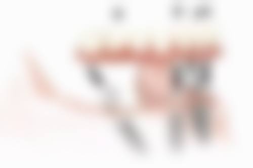 拔牙拍的片子叫什么？全景片——一览牙列全景的好帮手