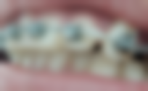 四、沈阳欢乐口腔李春玲医生坐诊医院