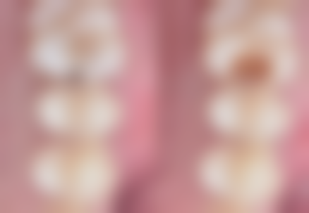 七、北京爵冠口腔吴思文医生怎么预约？