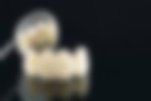 影响全瓷牙价格的多因素