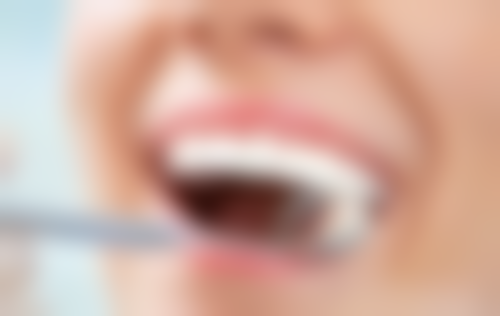 二次根管治疗为什么成功几率低之首次治疗的遗留问题