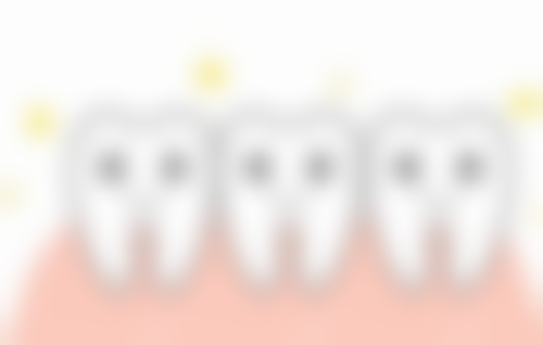 全烤瓷牙国产和进口的工艺差异