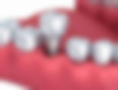 四、西安碑林齐贝口腔诊所特色项目